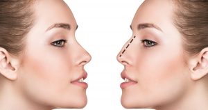 Comment combiner critères subjectifs et objectifs dans l’approche de la volumétrie du visage